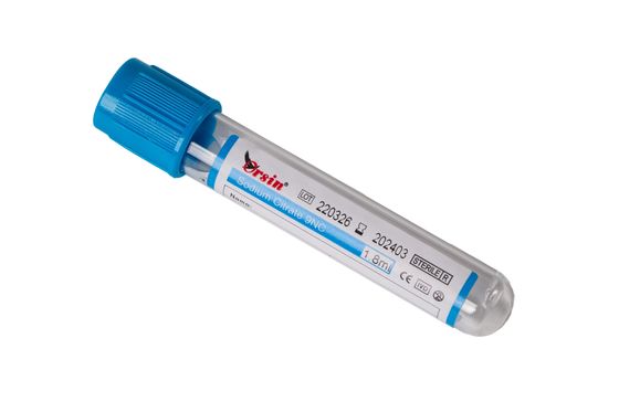 Sodium Citrate Blood Collection Tube with Vacuum Accuracy ≤3% and Critical Ratio Control 1:9 Featuring Silicone-Coated Interior