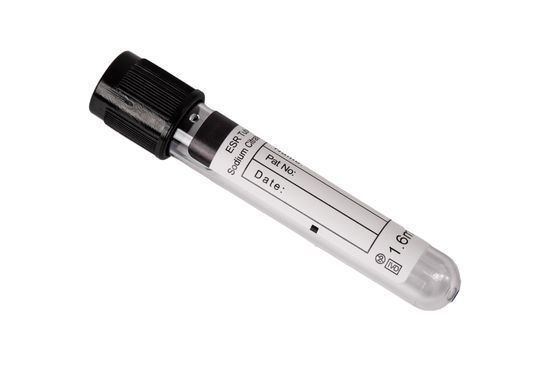 7ml 8ml 9ml 10ml ESR Glass Tube Anticoagulant Blood Tube For ESR