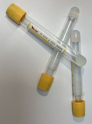 Screw Cap Rubber Stopper Vacuum Blood Collection Tube with Excellent Anticoagulant Properties for Serum Separation